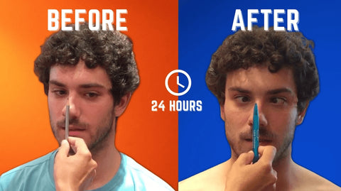 Fix Lazy Eye