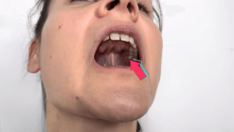 Jaw Position and Posture