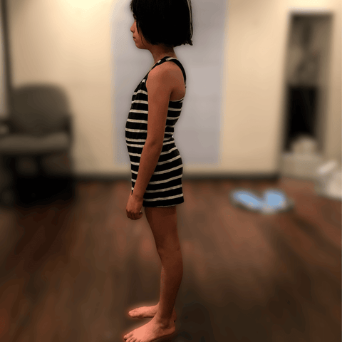 Kid posture before Therapeutic insoles