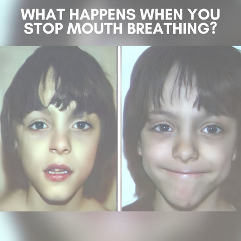 What Happens With the Functional Activator When You Stop Mouth Breathing?