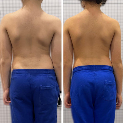 5-Minute Posture Fix